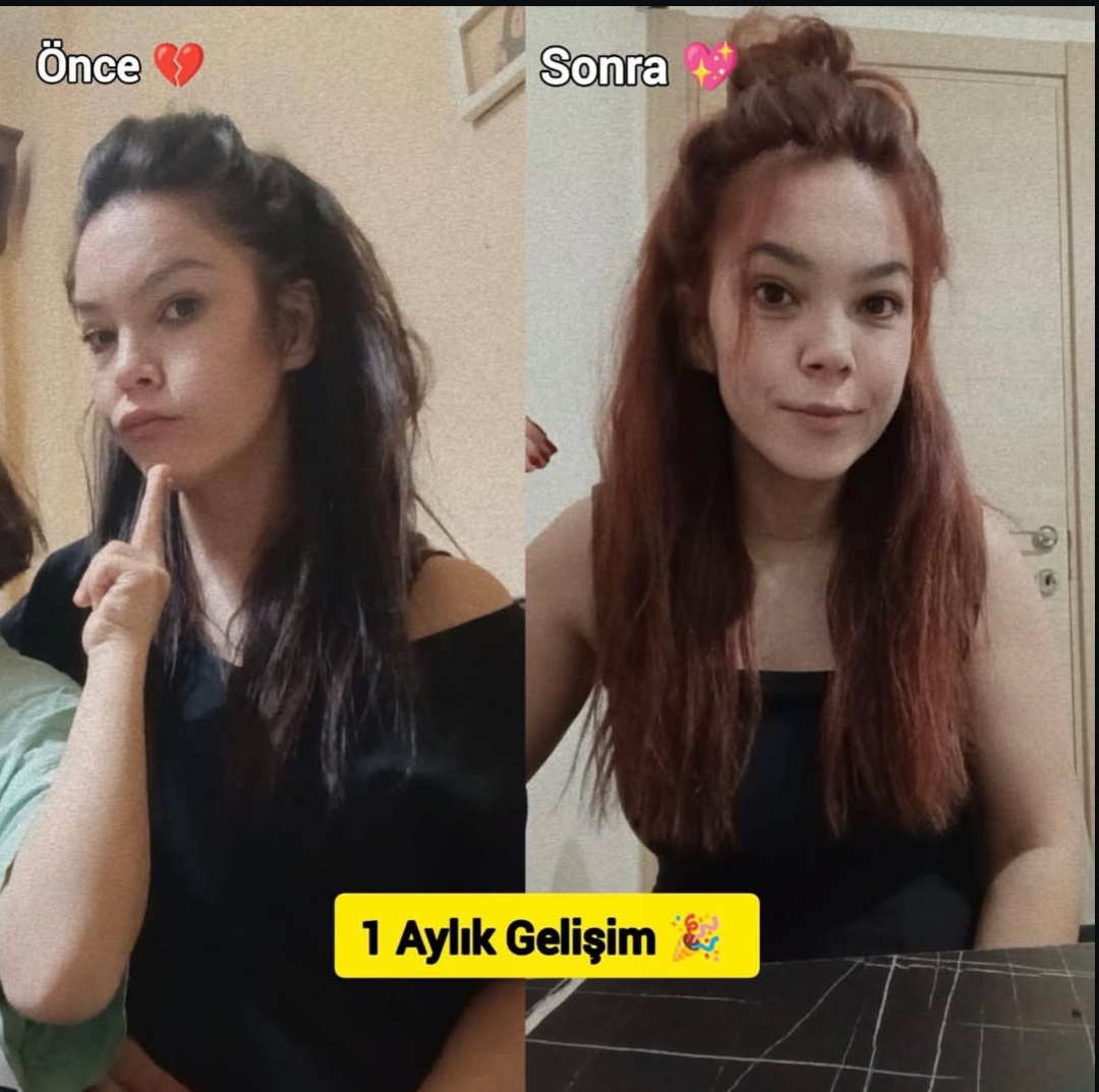Önce ve sonra - 1 aylık gelişim